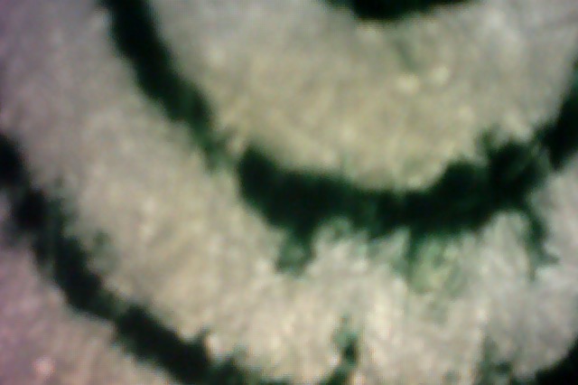 webcam microscope image